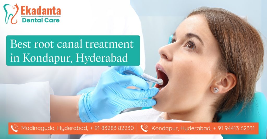 Best Root Canal Treatment in Kondapur, Hyderabad
