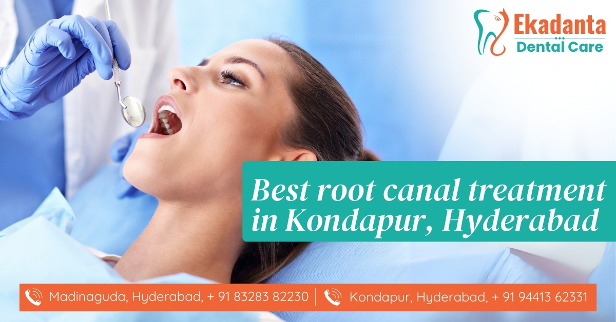 Root Canal Treatment in Kondapur