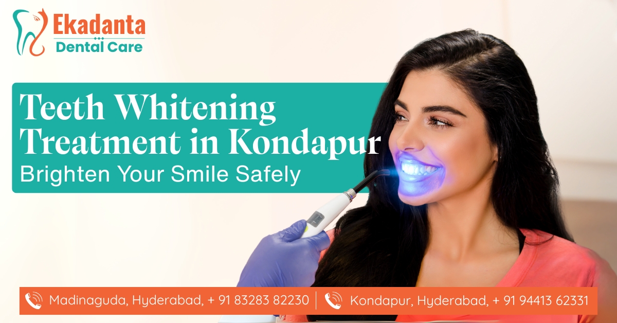 Teeth Whitening Treatment in Kondapur